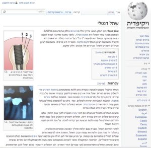 אתר שתל דנטלי בויקיפדיה